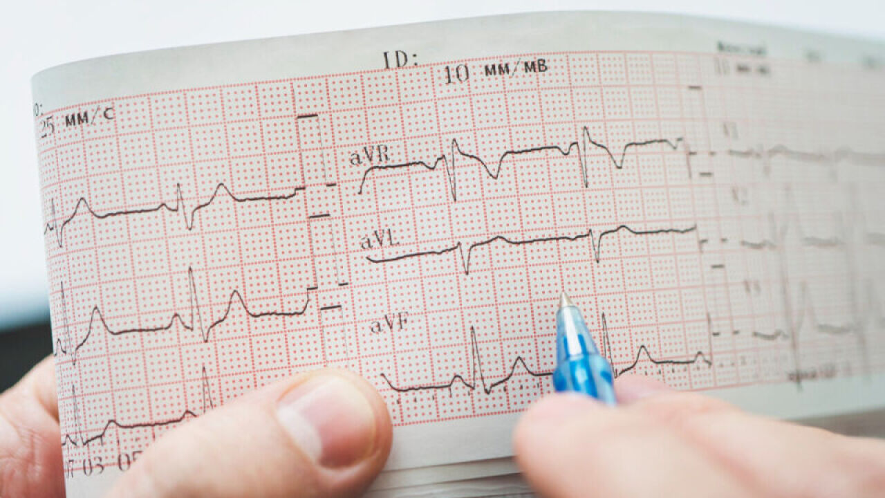 Badanie EKG a profilaktyka zdrowia serca