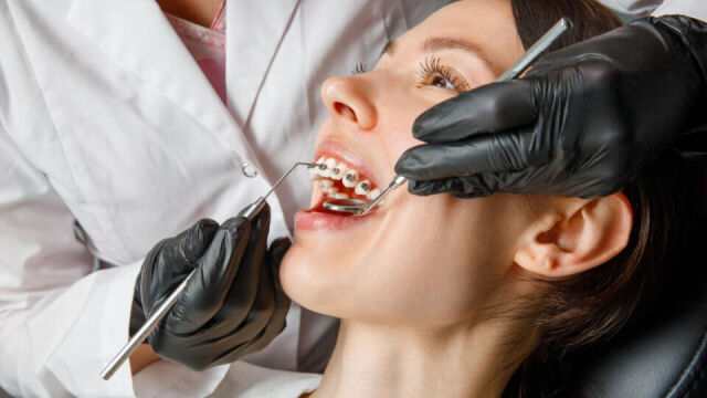 Dlaczego regularna higiena jamy ustnej jest ważna dla zapobiegania potrzebie leczenia kanałowego?